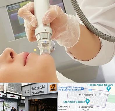 آر اف فرکشنال در منیریه 