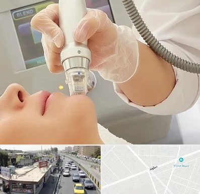آر اف فرکشنال در خیابان دماوند