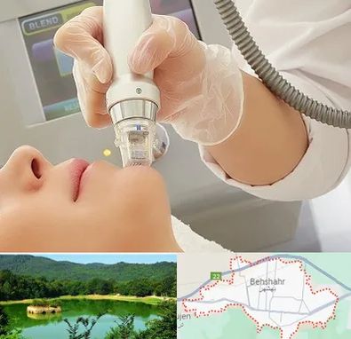 آر اف فرکشنال در بهشهر