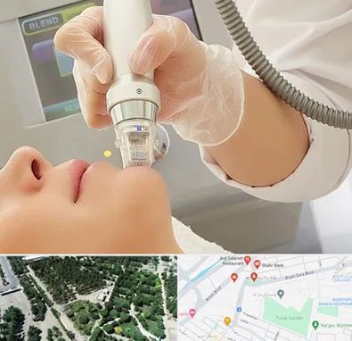 آر اف فرکشنال در سالاریه قم