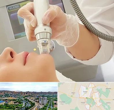 آر اف فرکشنال در شهریار