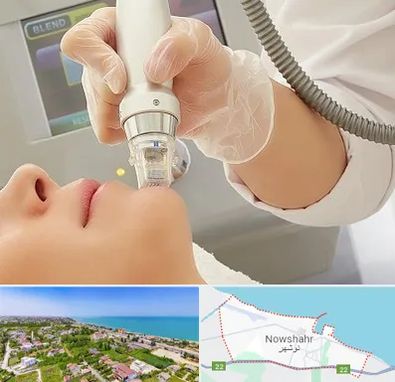 آر اف فرکشنال در نوشهر