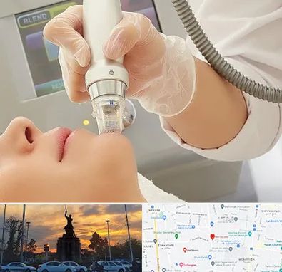 آر اف فرکشنال در میدان حر 