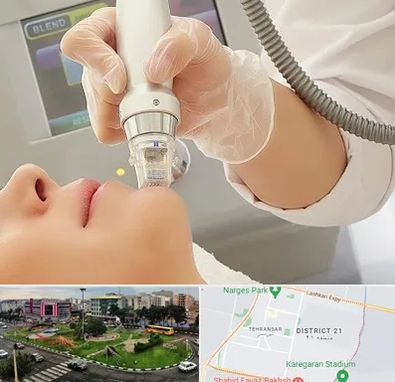 آر اف فرکشنال در تهرانسر 