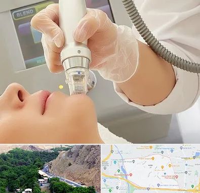 آر اف فرکشنال در کن 