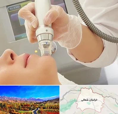 آر اف فرکشنال در خراسان شمالی