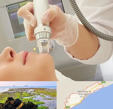 آر اف فرکشنال در بندرلنگه