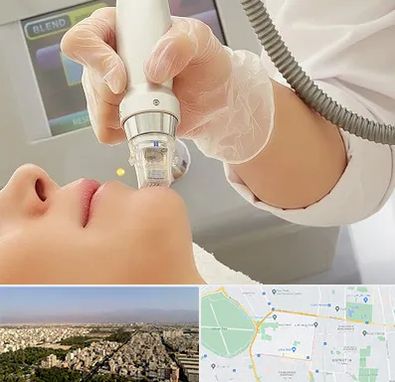 آر اف فرکشنال در نازی آباد