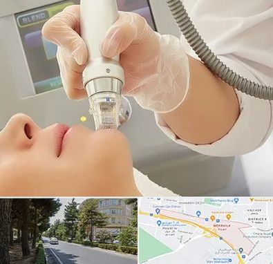 آر اف فرکشنال در مهرویلا کرج