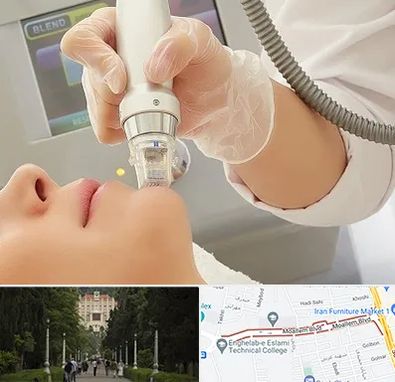 آر اف فرکشنال در بلوار معلم رشت 