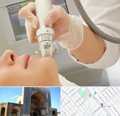 آر اف فرکشنال در مصلی مشهد