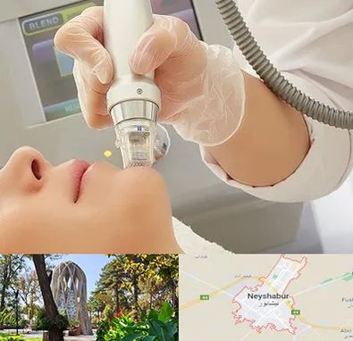 آر اف فرکشنال در نیشابور