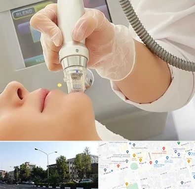 آر اف فرکشنال در میدان کاج 