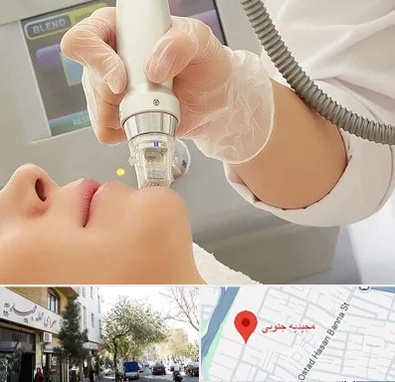 آر اف فرکشنال در مجیدیه جنوبی
