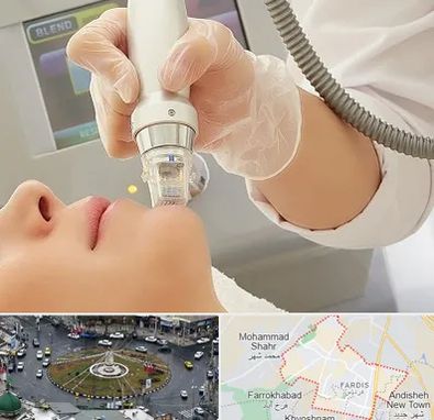 آر اف فرکشنال در فردیس کرج 