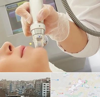 آر اف فرکشنال در محمد شهر کرج 