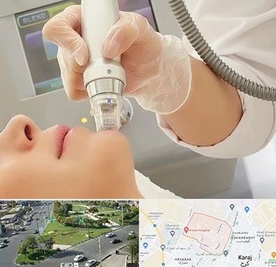 آر اف فرکشنال در شاهین ویلا کرج