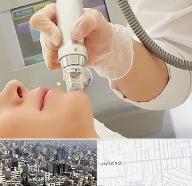 آر اف فرکشنال در جیحون