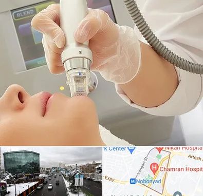 آر اف فرکشنال در اقدسیه 