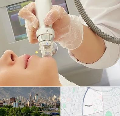 آر اف فرکشنال در جمشیدیه