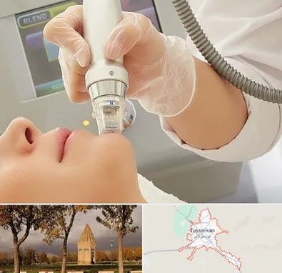 آر اف فرکشنال در تویسرکان