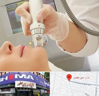 آر اف فرکشنال در امین حضور