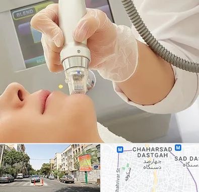 آر اف فرکشنال در چهارصد دستگاه 