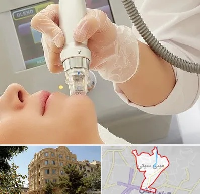 آر اف فرکشنال در مینی سیتی