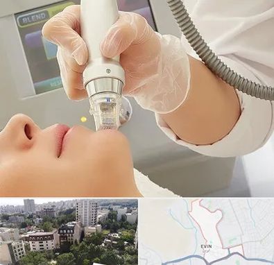 آر اف فرکشنال در اوین