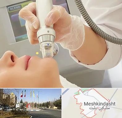 آر اف فرکشنال در مشکین دشت