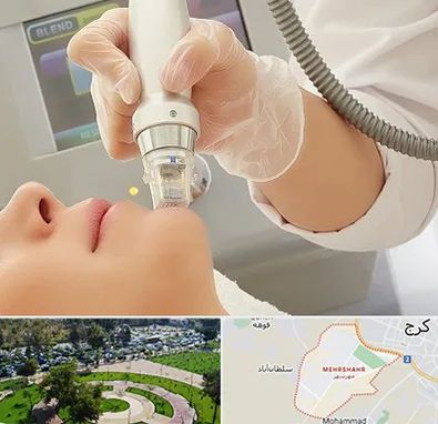 آر اف فرکشنال در مهرشهر کرج 