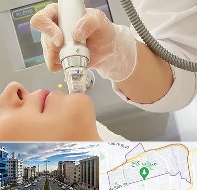 آر اف فرکشنال در سعادت آباد 