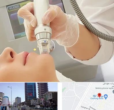 آر اف فرکشنال در چهارراه طالقانی کرج