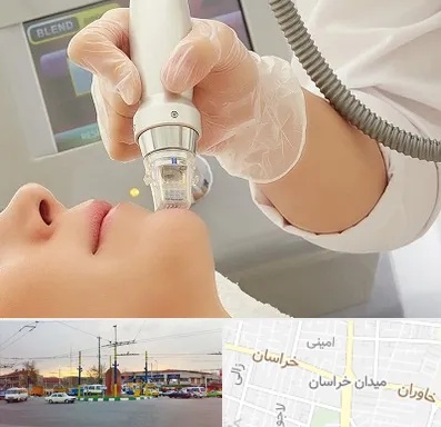 آر اف فرکشنال در میدان خراسان