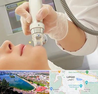 آر اف فرکشنال در لاهیجان