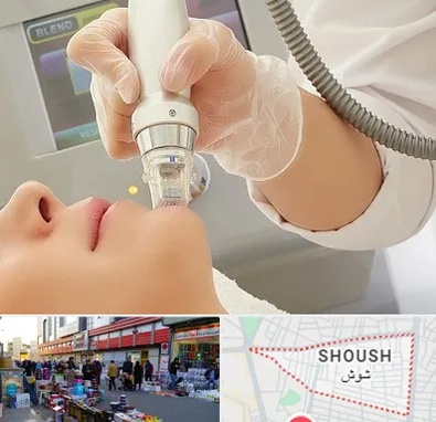 آر اف فرکشنال در شوش