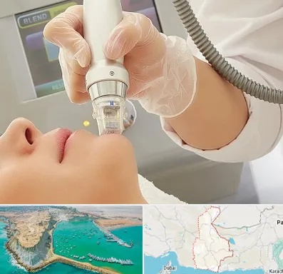 آر اف فرکشنال در سیستان و بلوچستان