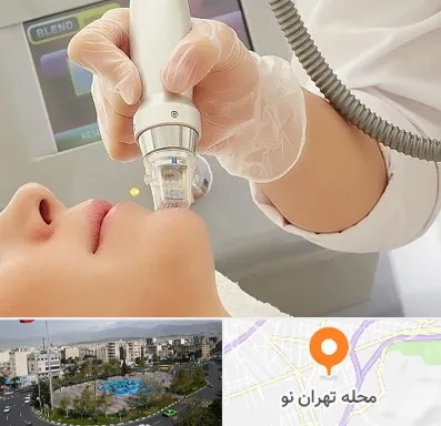 آر اف فرکشنال در تهران نو