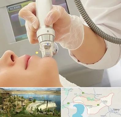 آر اف فرکشنال در شبستر