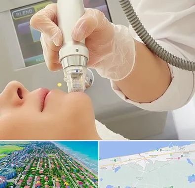 آر اف فرکشنال در فریدونکنار