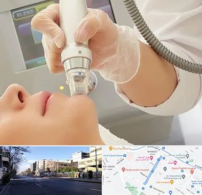 آر اف فرکشنال در خیابان ملاصدرا شیراز