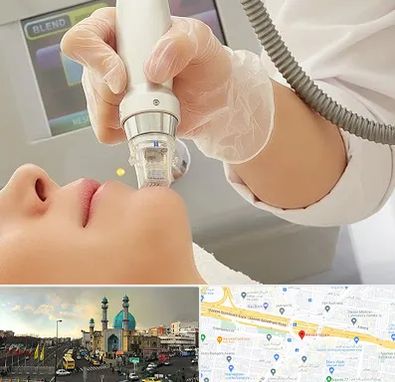 آر اف فرکشنال در رسالت 