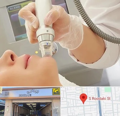 آر اف فرکشنال در رودکی