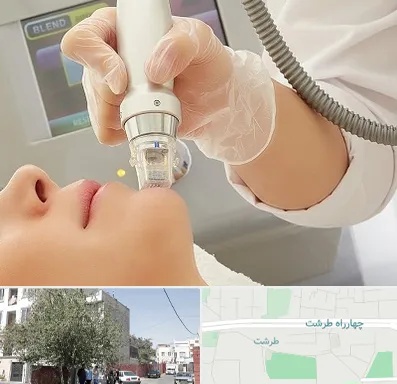 آر اف فرکشنال در طرشت