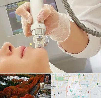 آر اف فرکشنال در منطقه 6 تهران 