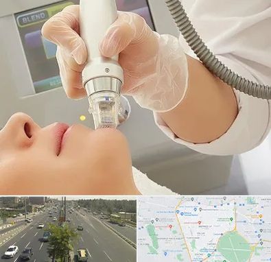 آر اف فرکشنال در منطقه 17 تهران 