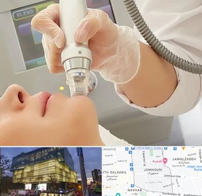 آر اف فرکشنال در جمهوری 