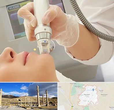 آر اف فرکشنال در مرودشت