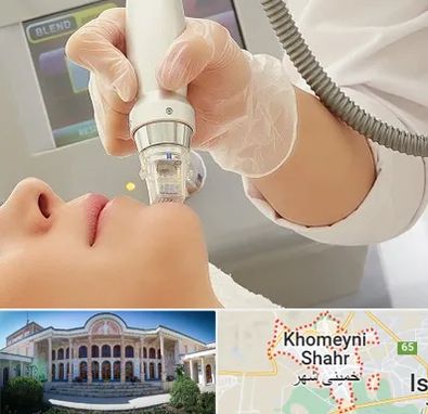 آر اف فرکشنال در خمینی شهر