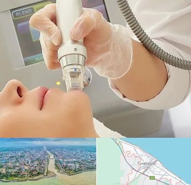 آر اف فرکشنال در تنکابن